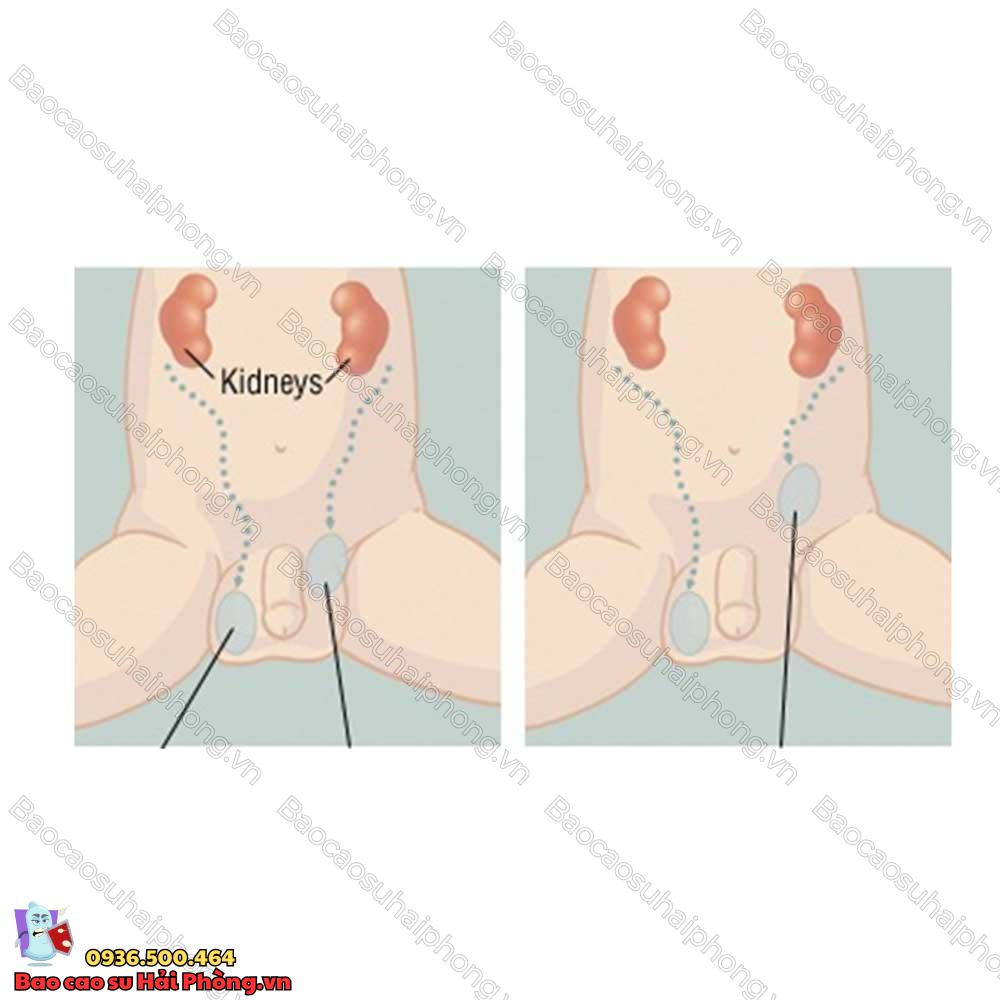 1-tinh-hoan-co-sinh-con-duoc-khong-2