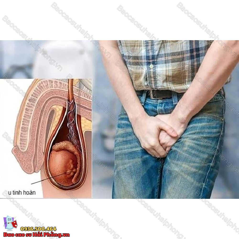 1-tinh-hoan-co-sinh-con-duoc-khong-3