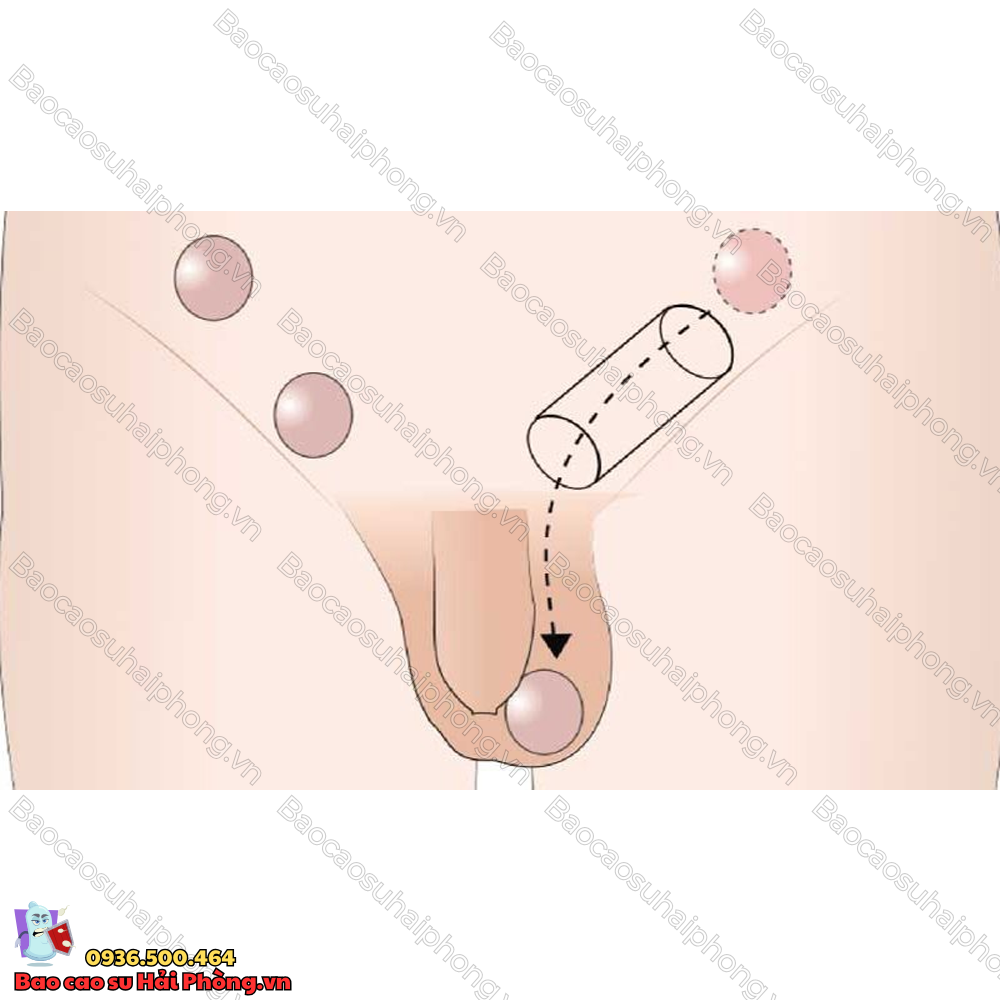 1-tinh-hoan-co-sinh-con-duoc-khong