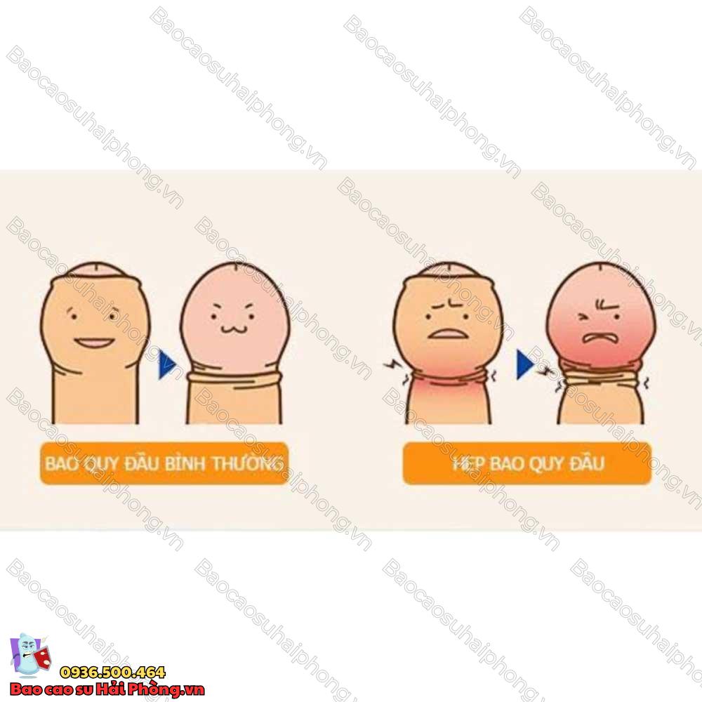 17-tuoi-chua-lot-bao-quy-dau-co-sao-khong-2