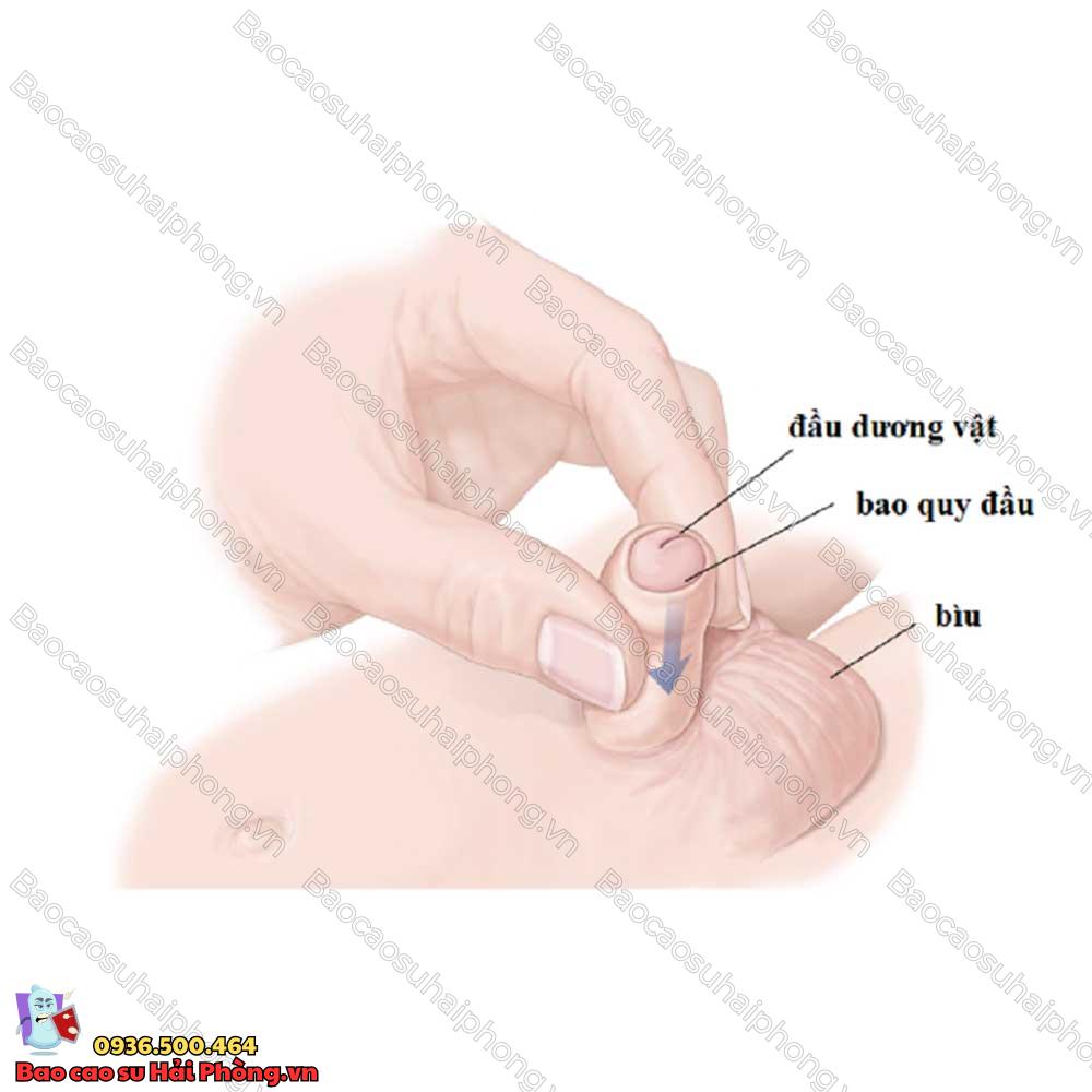 17-tuoi-chua-lot-bao-quy-dau-co-sao-khong-3