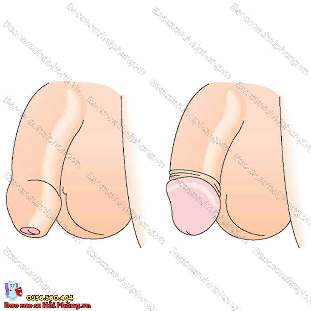 17-tuoi-chua-lot-bao-quy-dau-co-sao-khong-4