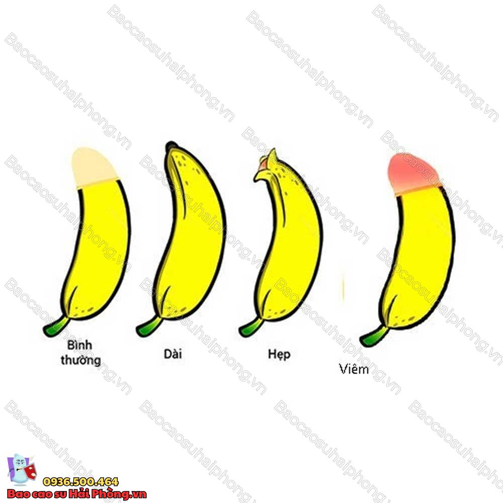 17-tuoi-chua-lot-bao-quy-dau-co-sao-khong-5