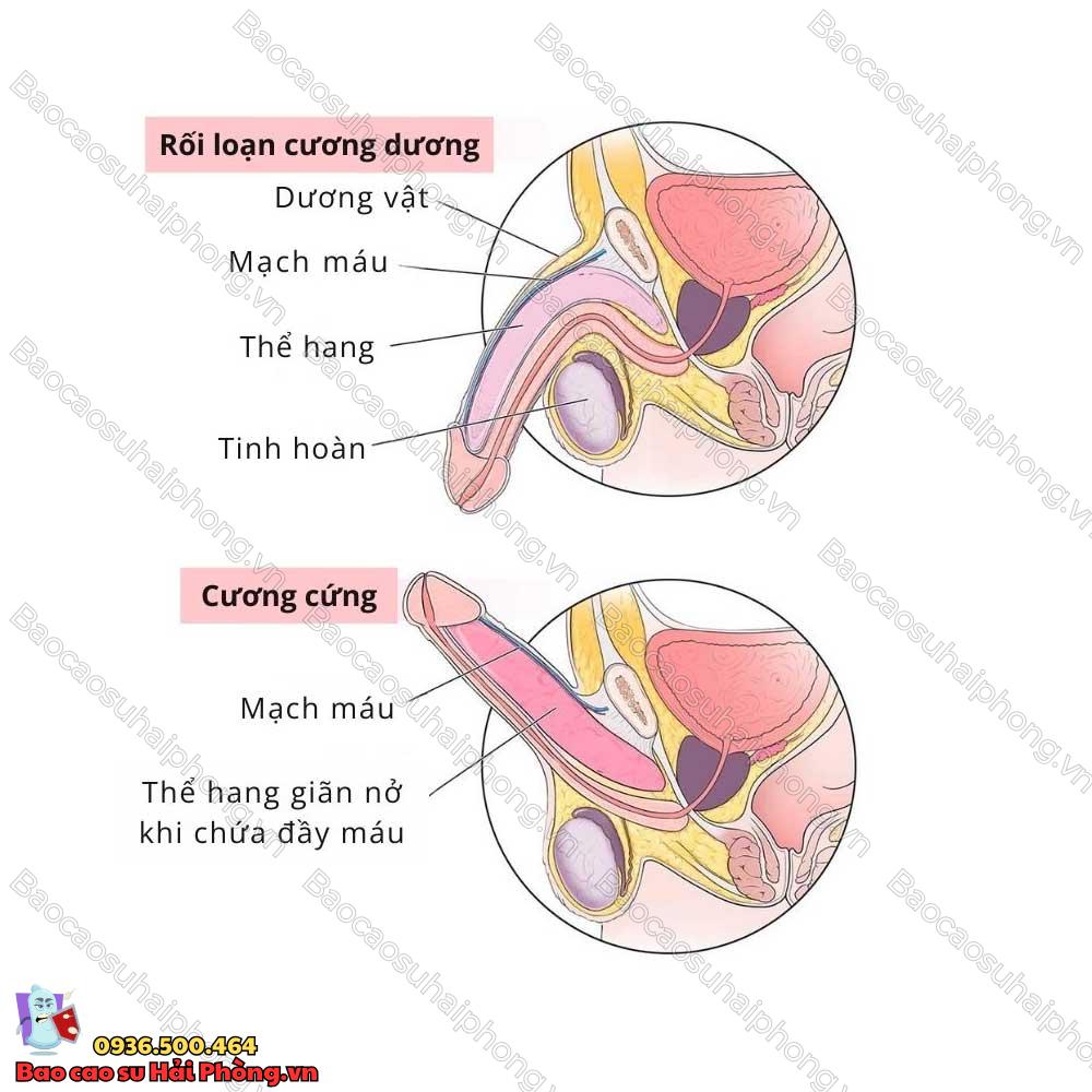 bai-tap-dieu-tri-roi-loan-cuong-duong
