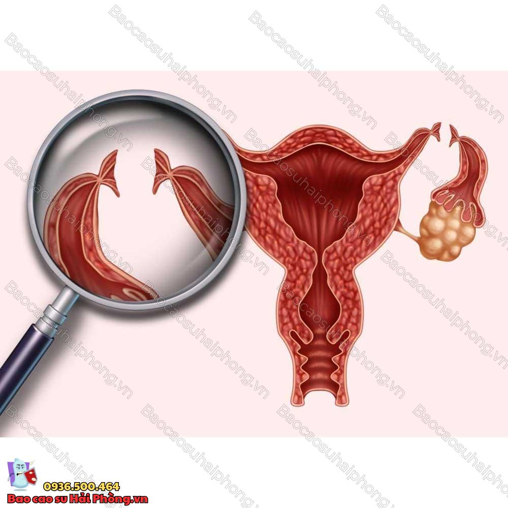 ban-da-biet-gi-ve-quy-trinh-that-ong-dan-trung-2