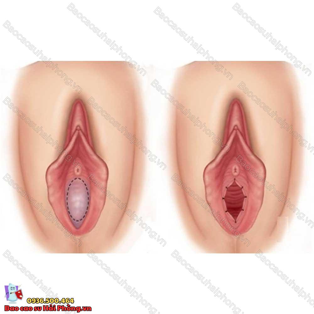 ban-hieu-gi-ve-mang-trinh-va-vi-tri-cua-mang-trinh