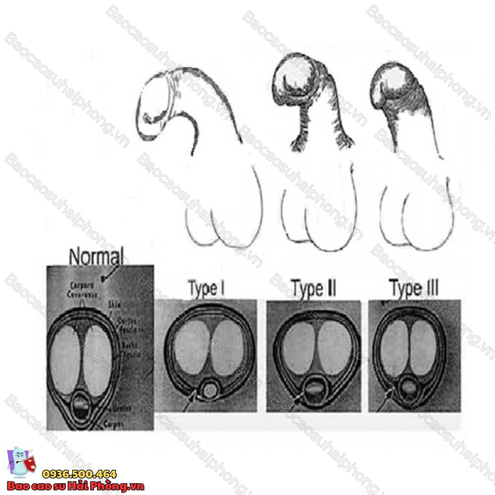 cac-hinh-dang-cua-cau-nho-2