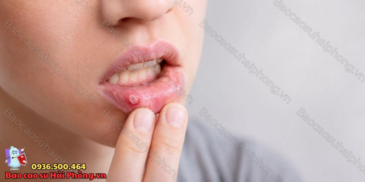 Quan hệ bằng miệng có thể lây truyền bệnh gì?
