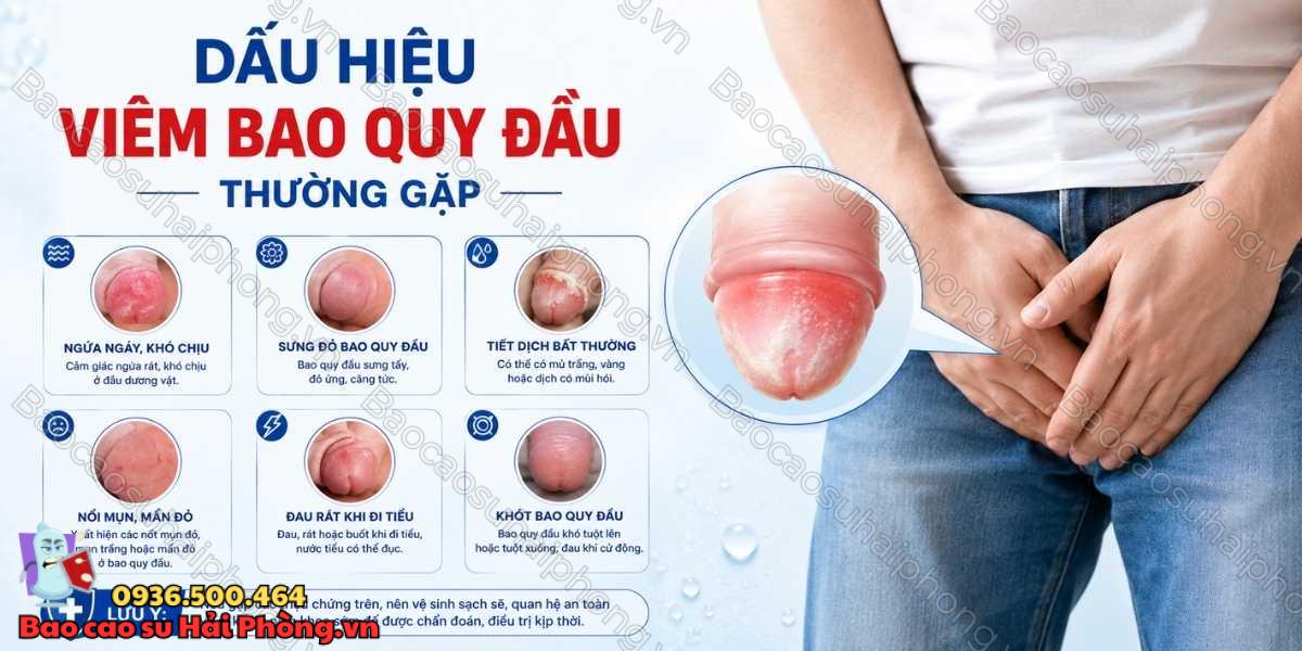 Viêm bao quy đầu là gì? Nguyên nhân và cách xử lý
