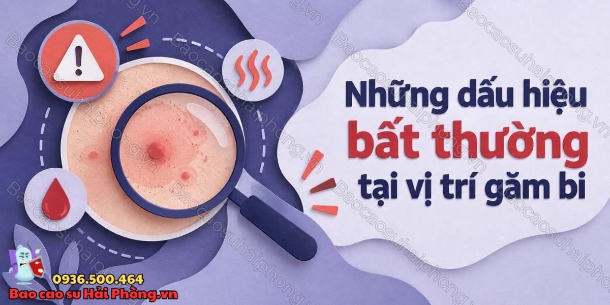 Những dấu hiệu bất thường sau khi găm bi